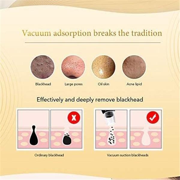 2024 Newest Blackhead Remover Pore Vacuum, Electric Facial Pore Cleaner with 5 Suction Levels,